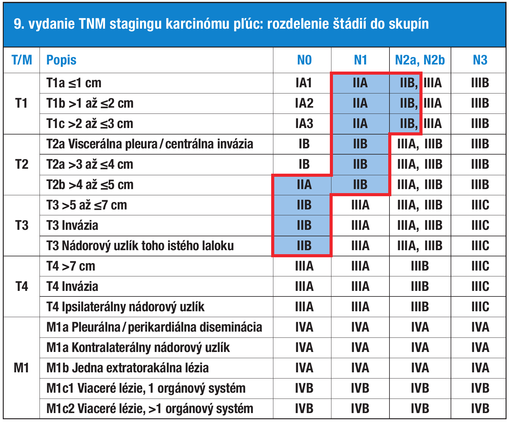 TNM klasifikácia – II. štádium zvýraznené modrou farbou a červeným obrysom.